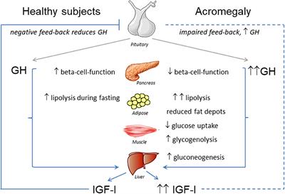 Insulin Resistance in Patients With Acromegaly